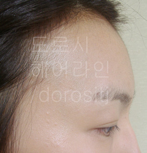 도로시헤어라인 이미지