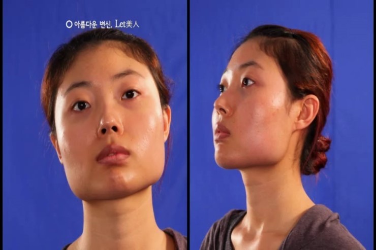 렛미인 이미지