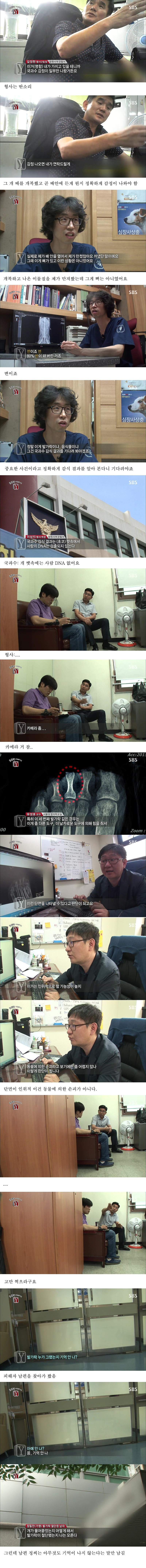 자고 일어났더니 사라진 발가락 (혐오주의) | 인스티즈