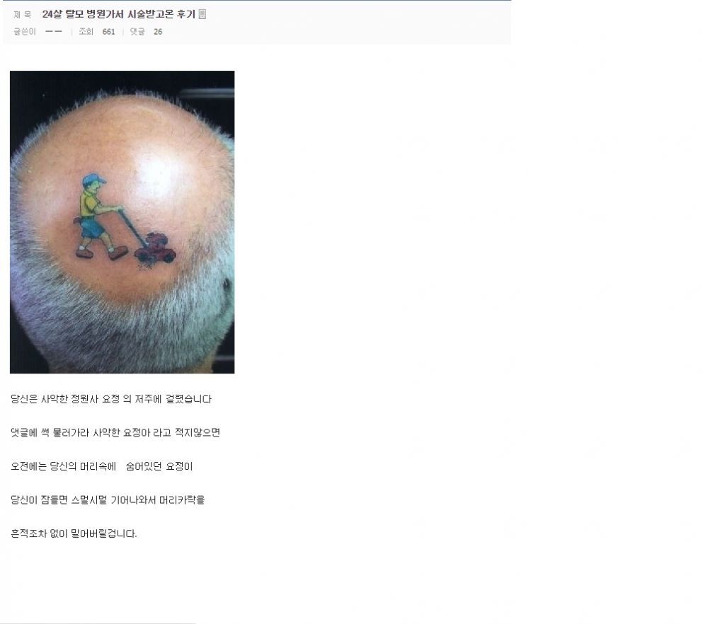 탈모갤러리의 간절함 | 인스티즈