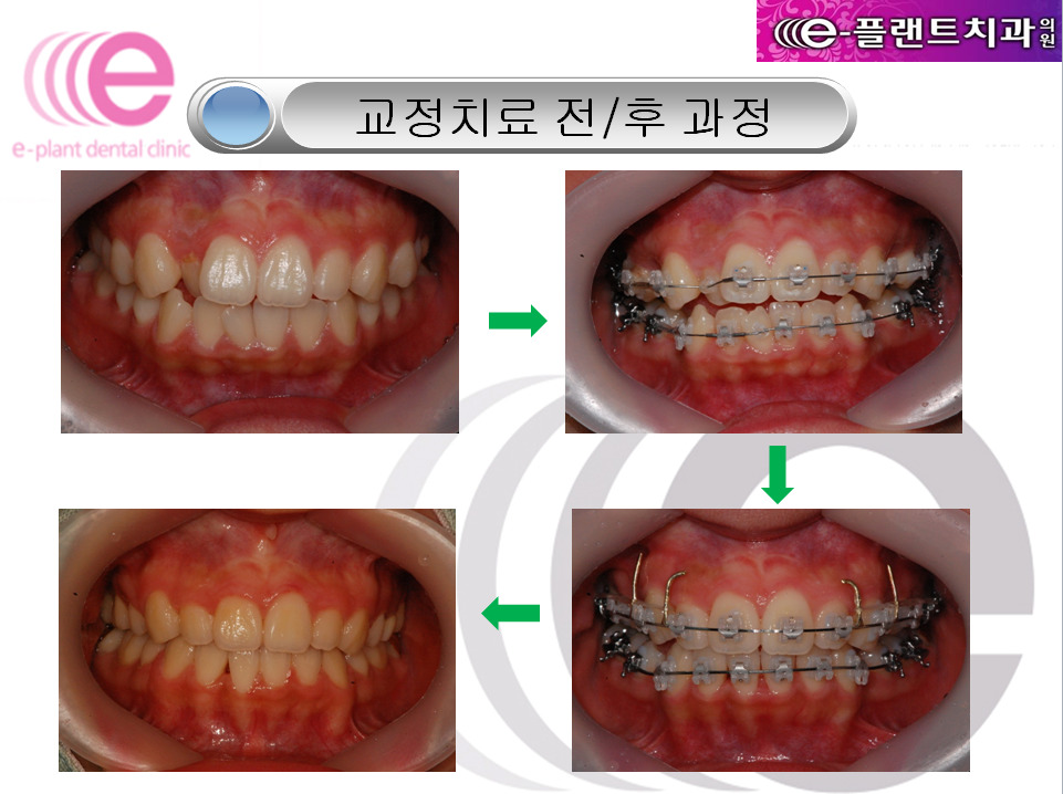 e-플랜트치과 이미지