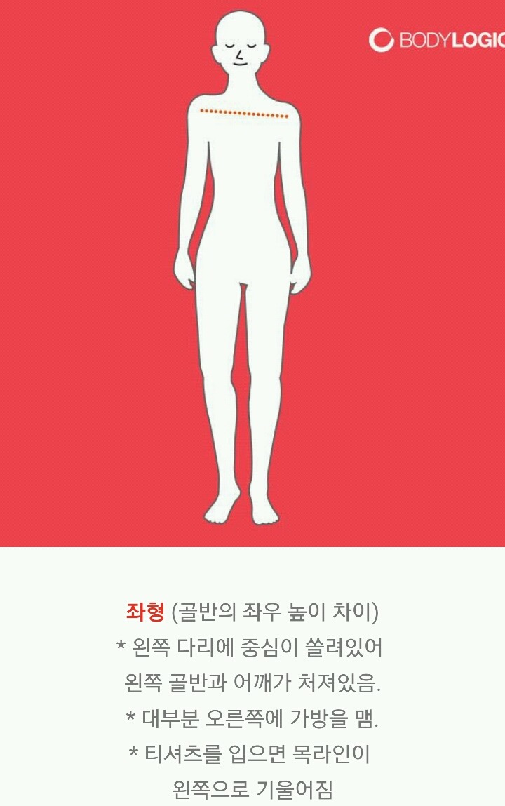 제자리걸음으로 골반틀어짐 확인하는 법 | 인스티즈