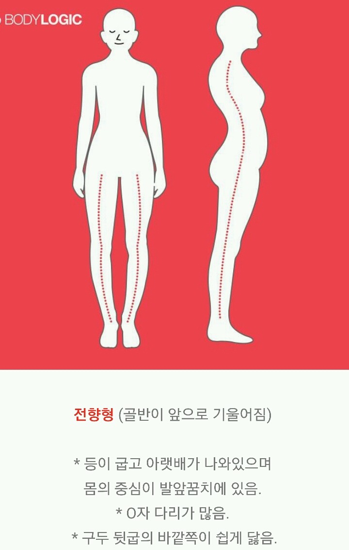 제자리걸음으로 골반틀어짐 확인하는 법 | 인스티즈