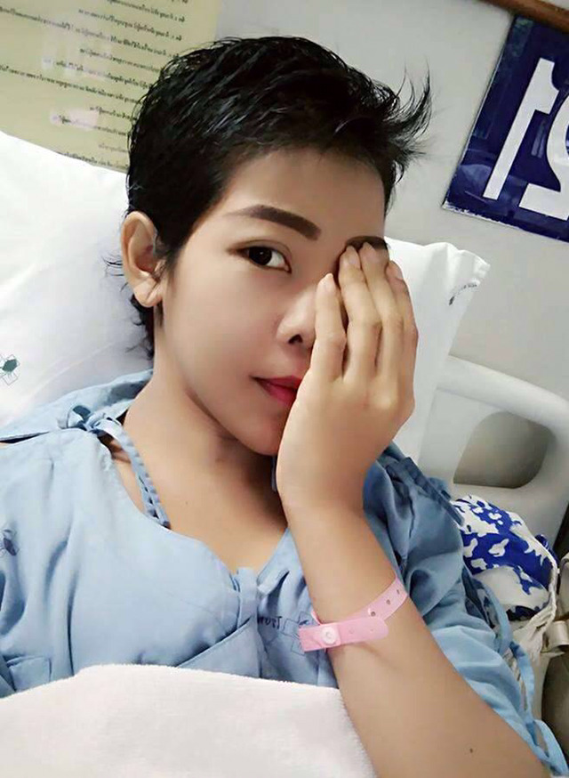 얼굴에 종양이 생긴 태국녀 ㅠㅜ | 인스티즈