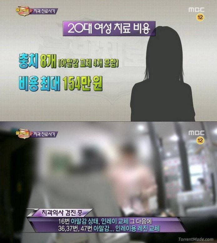 치과 치료의 진실 | 인스티즈