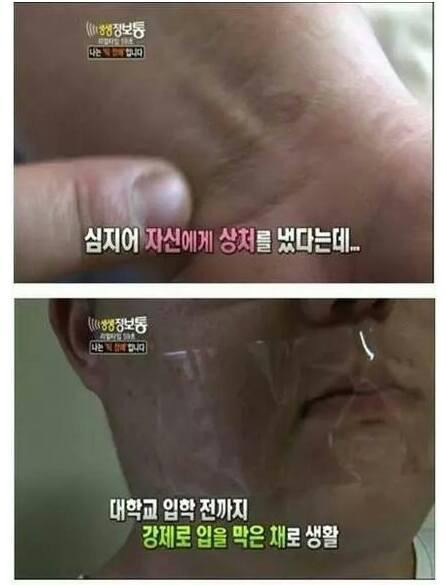 나는 '틱'장애인 입니다. 홍기호씨를 아시나요? | 인스티즈