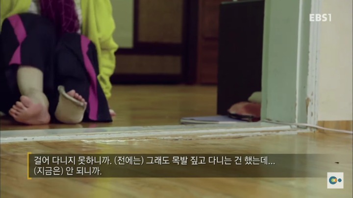 아픔을 느낄 수 없다면 좋은걸까? 무통증 환자 삼남매 이야기. #2 | 인스티즈