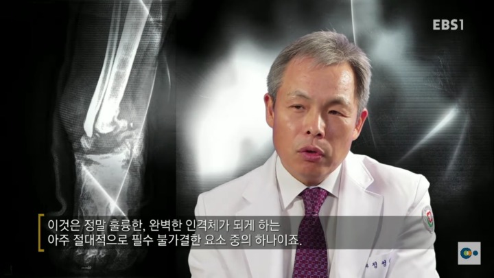 아픔을 느낄 수 없다면 좋은걸까? 무통증 환자 삼남매 이야기. #2 | 인스티즈