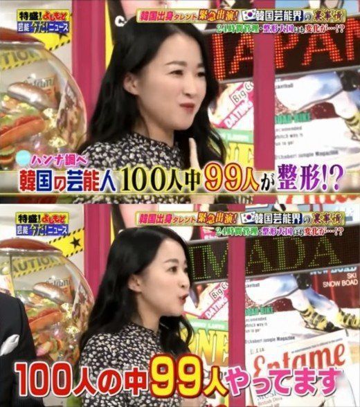 강한나, 日방송서 망언 논란…"연예인 100명 중 99명이 성형” | 인스티즈