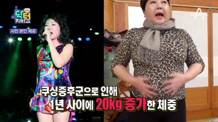 스테로이드 부작용 중 하나.jpg | 인스티즈