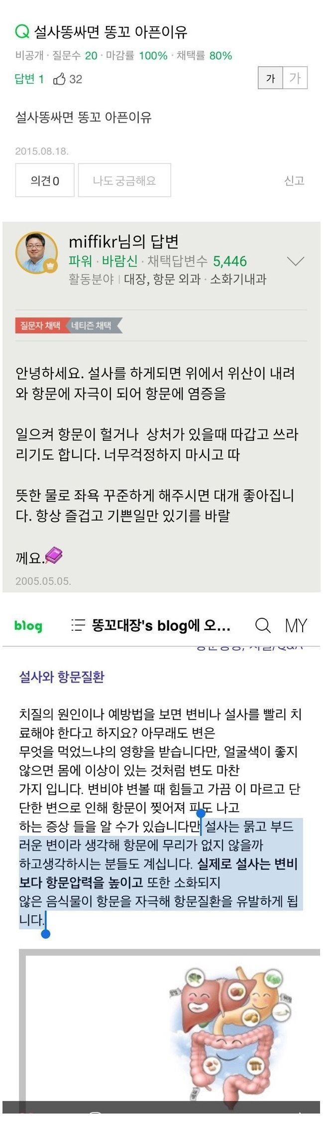 설사하면 항문통증 있는이유 | 인스티즈