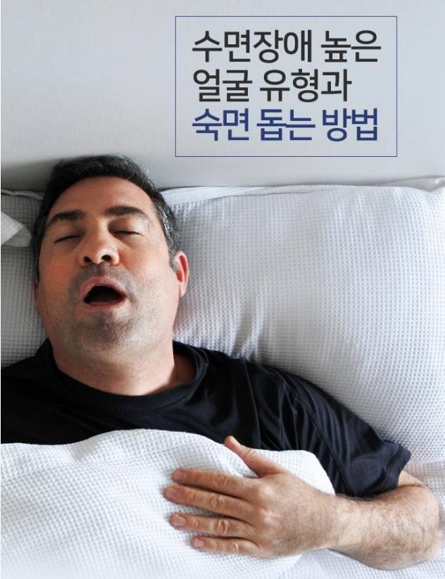 수면장애 높은 얼굴 유형과 숙면 돕는 방법 | 인스티즈