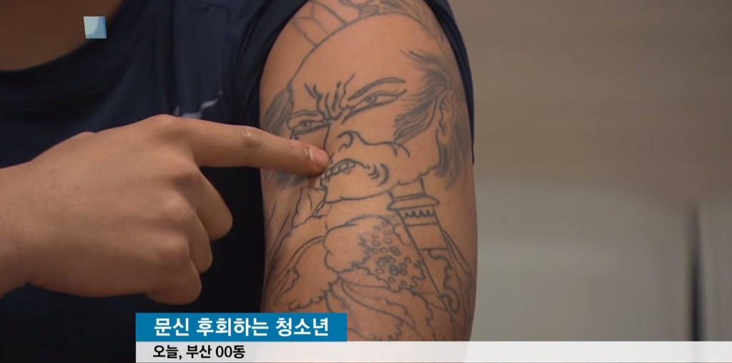 문신, 이제 지우고 싶어요! | 인스티즈